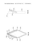 MITRAL VALVE REPLACEMENT TOGGLE CELL SECUREMENT diagram and image