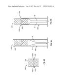 MITRAL VALVE REPLACEMENT TOGGLE CELL SECUREMENT diagram and image