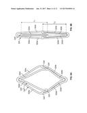 MITRAL VALVE REPLACEMENT TOGGLE CELL SECUREMENT diagram and image