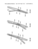 MITRAL VALVE REPLACEMENT TOGGLE CELL SECUREMENT diagram and image