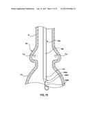 DELIVERY SYSTEM HAVING RETRACTABLE WIRES AS A COUPLING MECHANISM AND A     DEPLOYMENT MECHANISM FOR A SELF-EXPANDING PROSTHESIS diagram and image