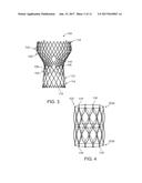 DEVICES AND METHODS FOR TRANSCATHETER VALVE LOADING AND IMPLANTATION diagram and image