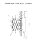 DEVICES AND METHODS FOR TRANSCATHETER VALVE LOADING AND IMPLANTATION diagram and image