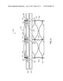 DEVICES AND METHODS FOR TRANSCATHETER VALVE LOADING AND IMPLANTATION diagram and image