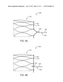 DEVICES AND METHODS FOR TRANSCATHETER VALVE LOADING AND IMPLANTATION diagram and image