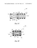 PERCUTANEOUS VALVE, SYSTEM AND METHOD diagram and image