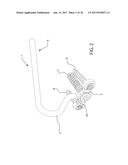 INTERNAL JOINT STABILIZER DEVICE, SYSTEM AND METHOD OF USE diagram and image