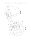 INTERNAL JOINT STABILIZER DEVICE, SYSTEM AND METHOD OF USE diagram and image