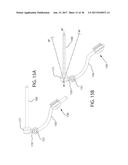 INTERNAL JOINT STABILIZER DEVICE, SYSTEM AND METHOD OF USE diagram and image