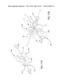 INTERNAL JOINT STABILIZER DEVICE, SYSTEM AND METHOD OF USE diagram and image