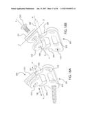 INTERNAL JOINT STABILIZER DEVICE, SYSTEM AND METHOD OF USE diagram and image