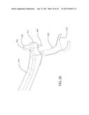 INTERNAL JOINT STABILIZER DEVICE, SYSTEM AND METHOD OF USE diagram and image