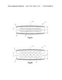 EXPANDABLE INTERVERTEBRAL IMPLANT AND ASSOCIATED METHOD OF MANUFACTURING     THE SAME diagram and image