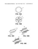 OCCLUSION IMPLANT diagram and image