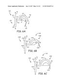 TINE FIXATION COMPONENTS FOR IMPLANTABLE MEDICAL DEVICES diagram and image