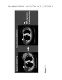 BIOMARKERS AND METHODS OF USE THEREOF diagram and image