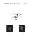 OPTICAL PROBE, LIGHT INTENSITY DETECTION, IMAGING METHOD AND SYSTEM diagram and image