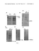 SPECIFIC BIOMARKER SET FOR NON-INVASIVE DIAGNOSIS OF LIVER CANCER diagram and image