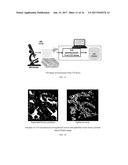 SYSTEMS AND METHODS FOR AUTOMATED SCREENING AND PROGNOSIS OF CANCER FROM     WHOLE-SLIDE BIOPSY IMAGES diagram and image