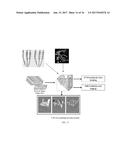 SYSTEMS AND METHODS FOR AUTOMATED SCREENING AND PROGNOSIS OF CANCER FROM     WHOLE-SLIDE BIOPSY IMAGES diagram and image