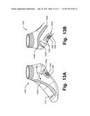 Articles of Apparel Providing Enhanced Body Position Feedback diagram and image