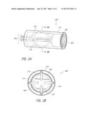 ENDOLUMINAL SIZING DEVICE diagram and image