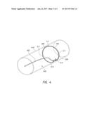 ENDOLUMINAL SIZING DEVICE diagram and image