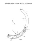 LATERAL ACCESS SYSTEM FOR THE LUMBAR SPINE diagram and image