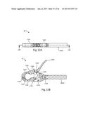 LATERAL ACCESS SYSTEM FOR THE LUMBAR SPINE diagram and image