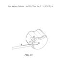 SURGICAL ACCESS SYSTEM AND RELATED METHODS diagram and image