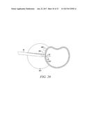 SURGICAL ACCESS SYSTEM AND RELATED METHODS diagram and image