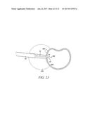 SURGICAL ACCESS SYSTEM AND RELATED METHODS diagram and image