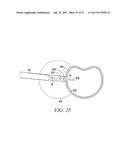 SURGICAL ACCESS SYSTEM AND RELATED METHODS diagram and image