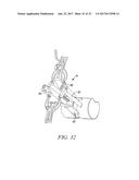 SURGICAL ACCESS SYSTEM AND RELATED METHODS diagram and image