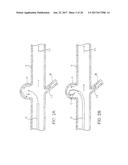 ANEURSYM OCCLUSION SYSTEM AND METHOD diagram and image