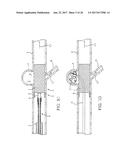 ANEURSYM OCCLUSION SYSTEM AND METHOD diagram and image