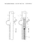 ANEURSYM OCCLUSION SYSTEM AND METHOD diagram and image