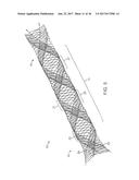 ANEURSYM OCCLUSION SYSTEM AND METHOD diagram and image