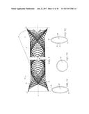 ANEURSYM OCCLUSION SYSTEM AND METHOD diagram and image