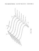 ANEURSYM OCCLUSION SYSTEM AND METHOD diagram and image