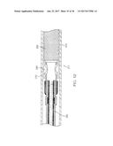 ANEURSYM OCCLUSION SYSTEM AND METHOD diagram and image