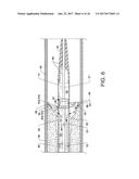 DIRECT STREAM HYDRODYNAMIC CATHETER SYSTEM diagram and image