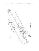 DIRECT STREAM HYDRODYNAMIC CATHETER SYSTEM diagram and image