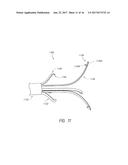 ANCHORING MECHANISMS AND SYSTEMS FOR ENDOLUMINAL DEVICES diagram and image