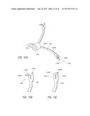 ANCHORING MECHANISMS AND SYSTEMS FOR ENDOLUMINAL DEVICES diagram and image