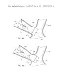 ANCHORING MECHANISMS AND SYSTEMS FOR ENDOLUMINAL DEVICES diagram and image