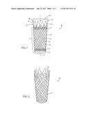 INTRALUMINAL DEVICE AND METHOD diagram and image