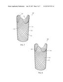 INTRALUMINAL DEVICE AND METHOD diagram and image