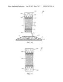 INTRALUMINAL DEVICE AND METHOD diagram and image