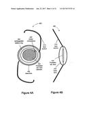 EYEWEAR INCLUDING A REMOTE CONTROL CAMERA diagram and image